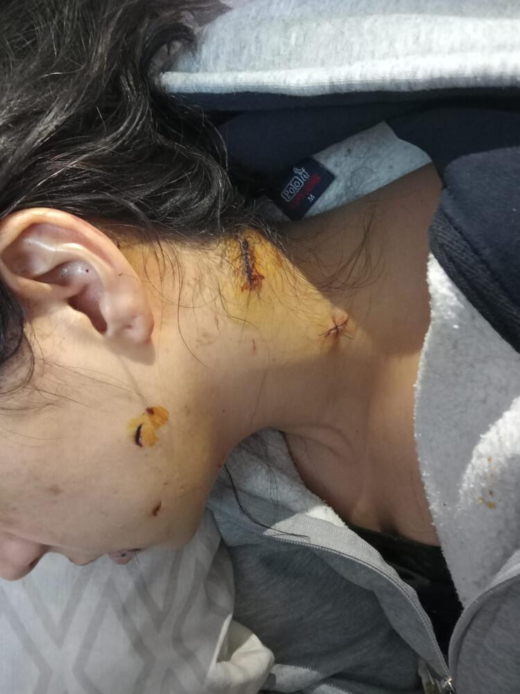 Mehtap öğretmen gözünü kaybetti! Eşinin kardeşi canavarca saldırdı - Resim: 16