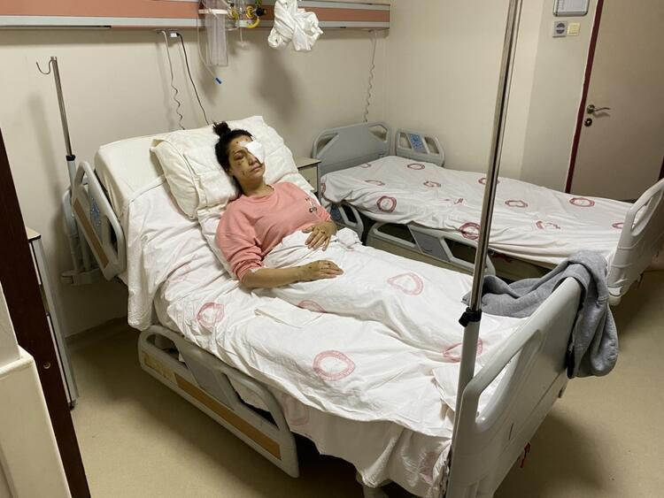 Mehtap öğretmen gözünü kaybetti! Eşinin kardeşi canavarca saldırdı - Resim: 11