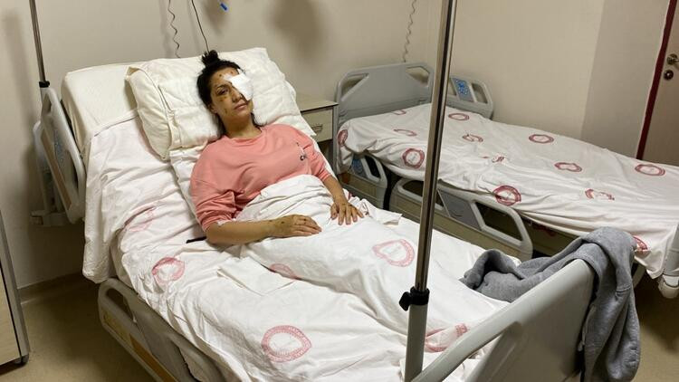 Mehtap öğretmen gözünü kaybetti! Eşinin kardeşi canavarca saldırdı - Resim: 12