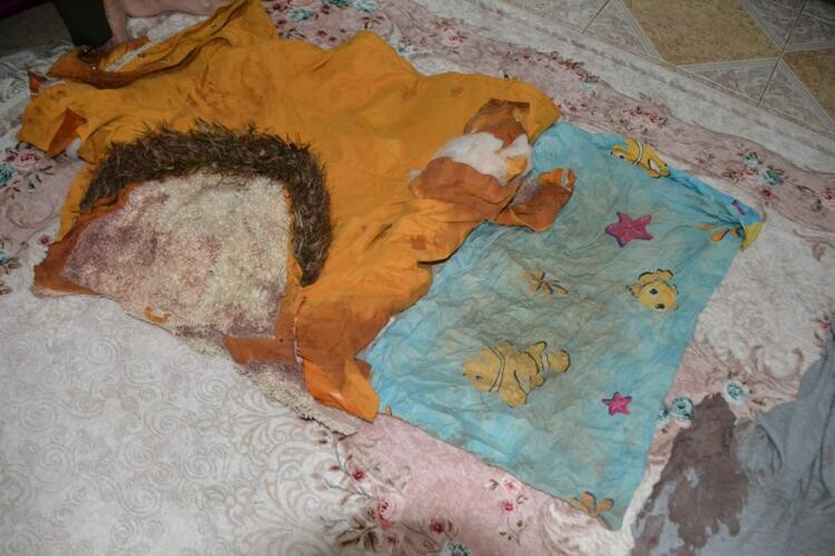 Mehtap öğretmen gözünü kaybetti! Eşinin kardeşi canavarca saldırdı - Resim: 10