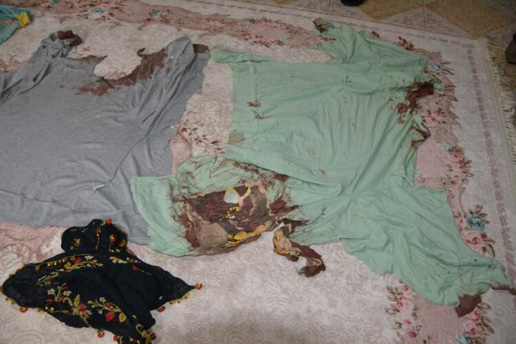 Mehtap öğretmen gözünü kaybetti! Eşinin kardeşi canavarca saldırdı - Resim: 8