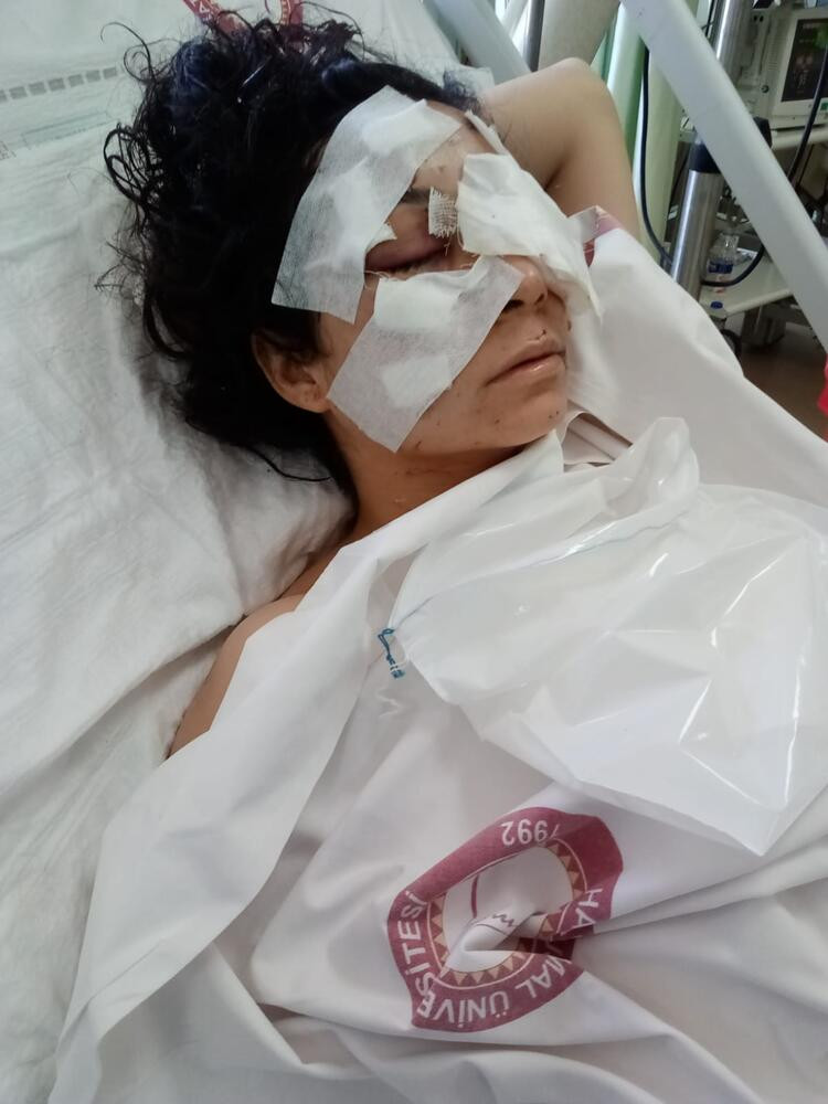 Mehtap öğretmen gözünü kaybetti! Eşinin kardeşi canavarca saldırdı - Resim: 6