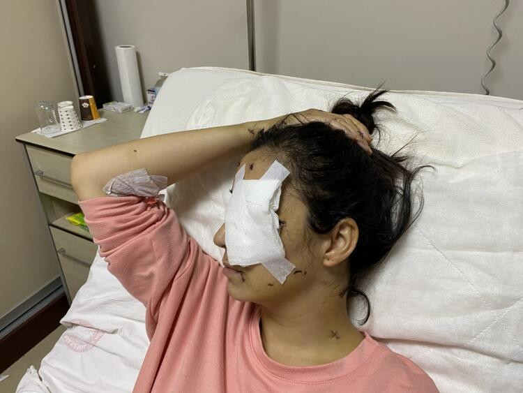 Mehtap öğretmen gözünü kaybetti! Eşinin kardeşi canavarca saldırdı - Resim: 3