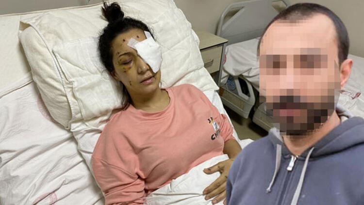 Mehtap öğretmen gözünü kaybetti! Eşinin kardeşi canavarca saldırdı - Resim: 1