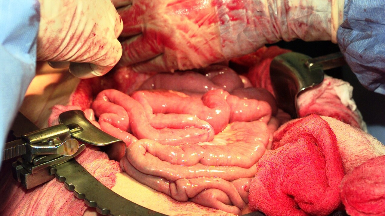 İç organlarımız gerçekte nasıl görünür? - Resim: 9