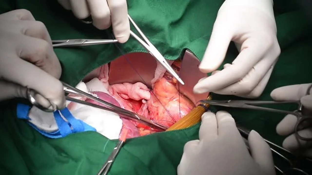 İç organlarımız gerçekte nasıl görünür? - Resim: 8