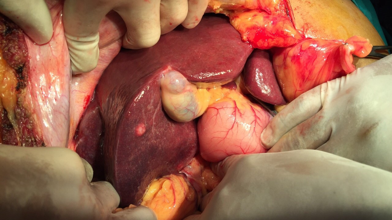 İç organlarımız gerçekte nasıl görünür? - Resim: 7