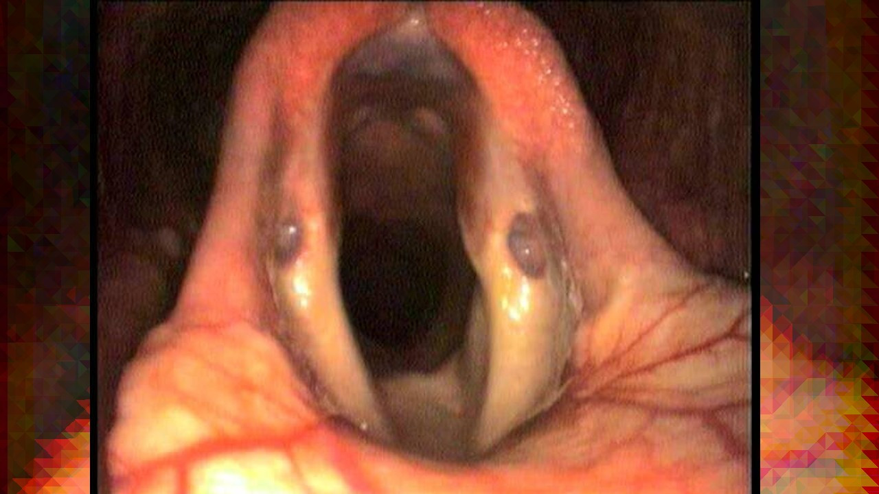 İç organlarımız gerçekte nasıl görünür? - Resim: 6