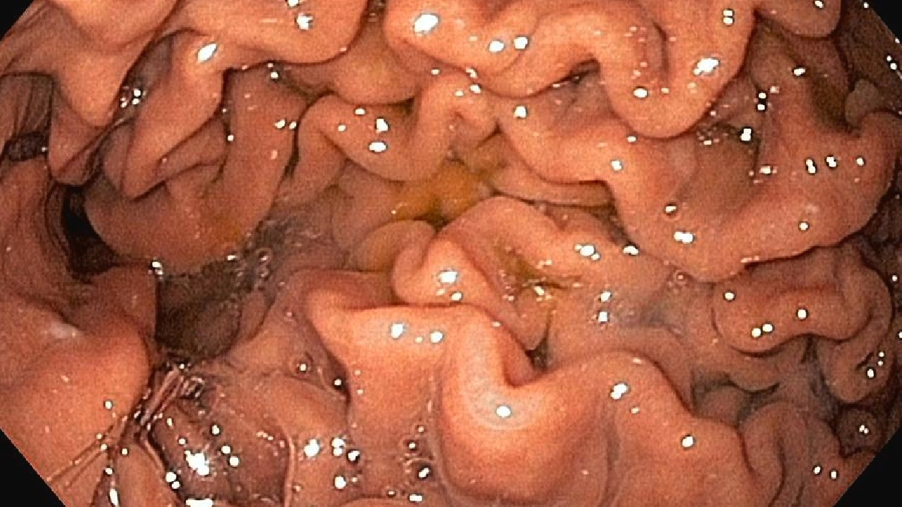 İç organlarımız gerçekte nasıl görünür? - Resim: 5