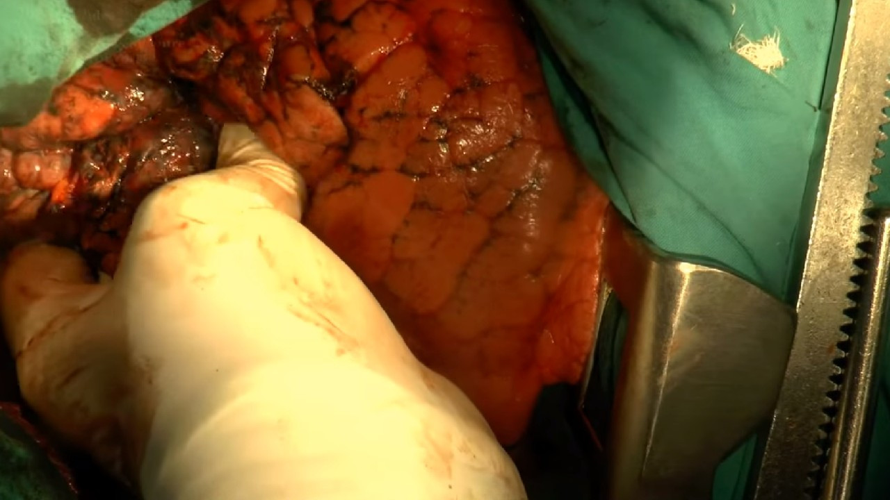 İç organlarımız gerçekte nasıl görünür? - Resim: 4