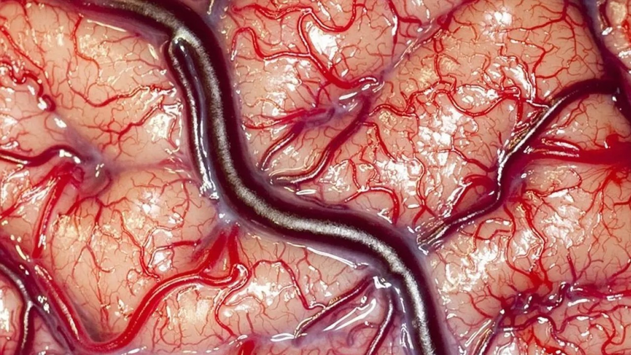 İç organlarımız gerçekte nasıl görünür? - Resim: 2