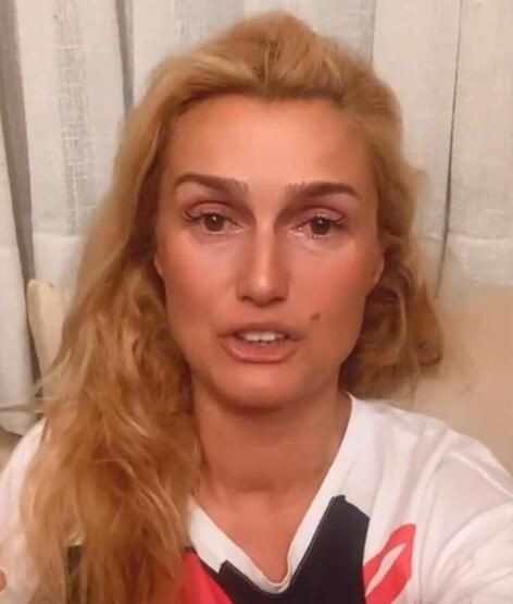 Ünlülerin bilinmeyen hastalıkları ortaya çıktı! Üçü de aynı dertten kendini yiyip bitiriyor - Resim: 31