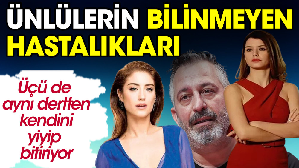 Ünlülerin bilinmeyen hastalıkları ortaya çıktı! Üçü de aynı dertten kendini yiyip bitiriyor - Resim: 1
