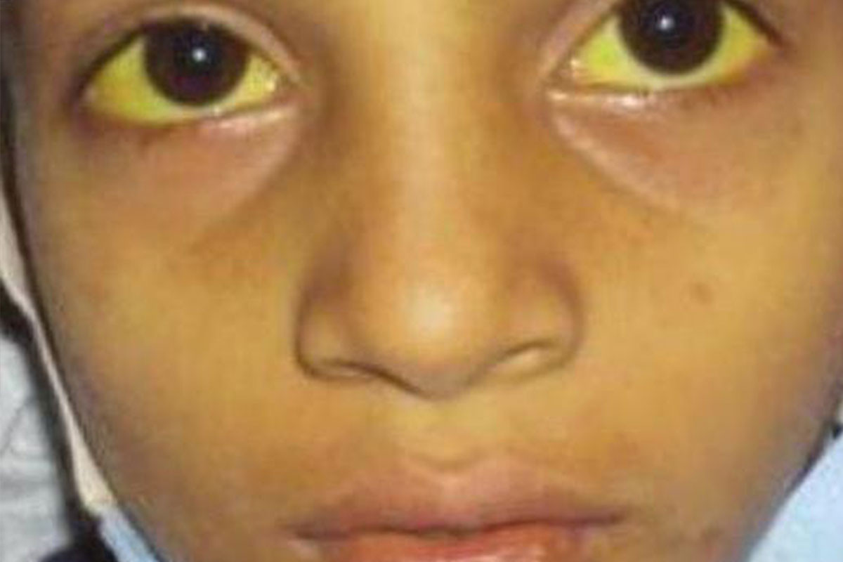 Yüz binlerce kişi taşıyıcı: 2 dakikada, 1 kişiyi öldürüyor - Resim: 2