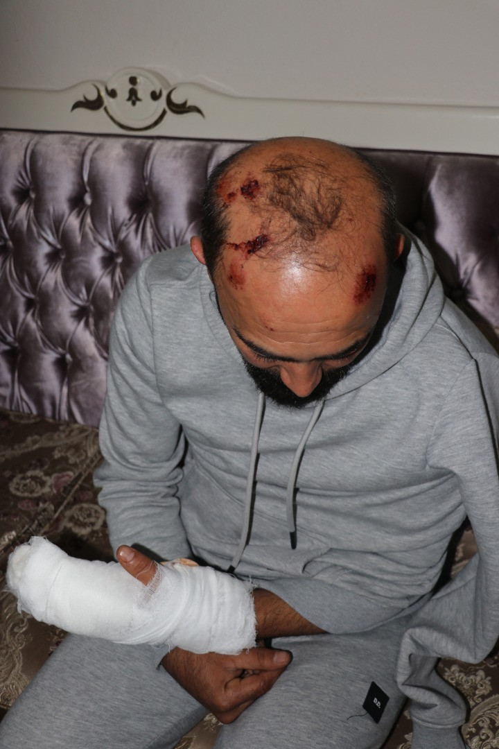 Takside dehşet! Başına taşla vurup hastanelik etti - Resim: 1