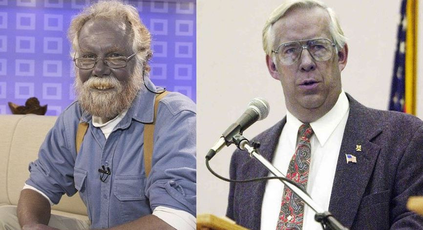 Mavi Adam ve Şirin Baba lakapları takıldı. Kocakarı ilacı yaptı rengi maviye döndü - Resim: 13