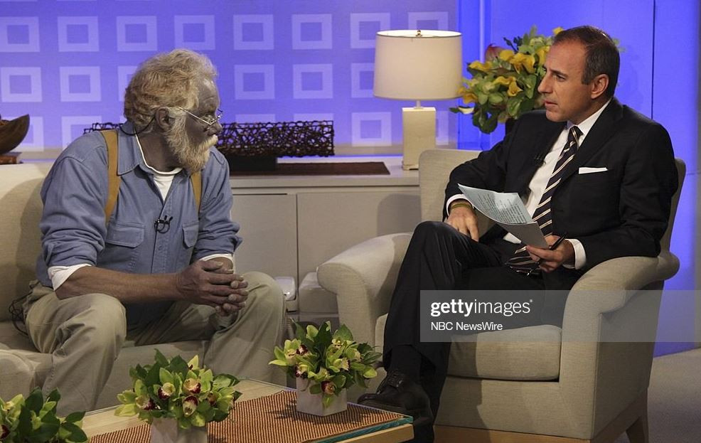 Mavi Adam ve Şirin Baba lakapları takıldı. Kocakarı ilacı yaptı rengi maviye döndü - Resim: 14