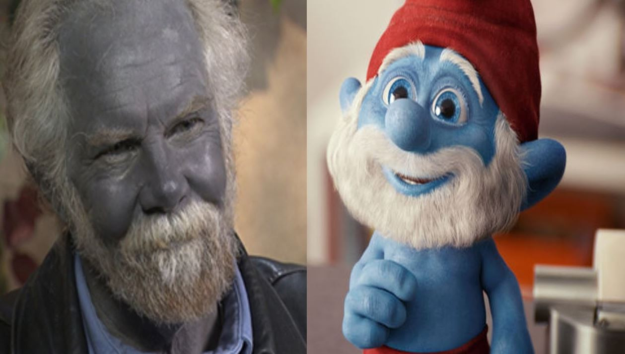 Mavi Adam ve Şirin Baba lakapları takıldı. Kocakarı ilacı yaptı rengi maviye döndü - Resim: 2