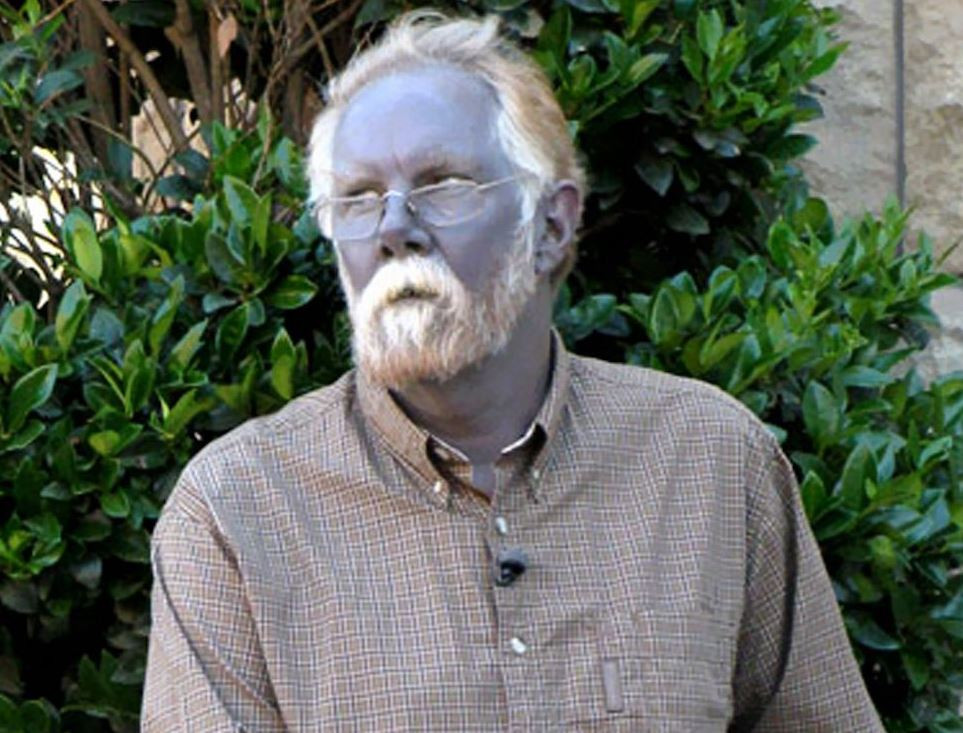 Mavi Adam ve Şirin Baba lakapları takıldı. Kocakarı ilacı yaptı rengi maviye döndü - Resim: 12