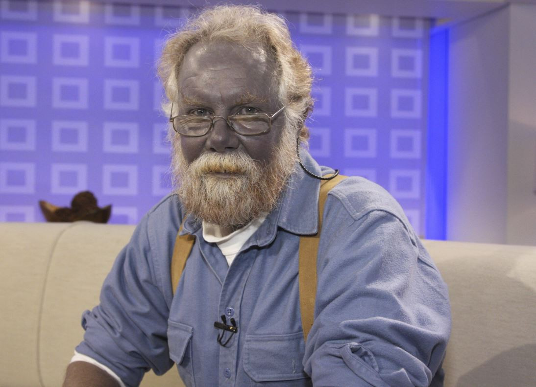 Mavi Adam ve Şirin Baba lakapları takıldı. Kocakarı ilacı yaptı rengi maviye döndü - Resim: 3