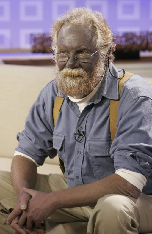 Mavi Adam ve Şirin Baba lakapları takıldı. Kocakarı ilacı yaptı rengi maviye döndü - Resim: 5