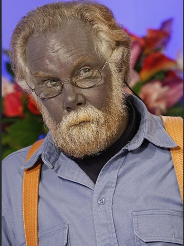 Mavi Adam ve Şirin Baba lakapları takıldı. Kocakarı ilacı yaptı rengi maviye döndü - Resim: 7