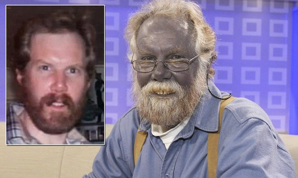 Mavi Adam ve Şirin Baba lakapları takıldı. Kocakarı ilacı yaptı rengi maviye döndü - Resim: 6