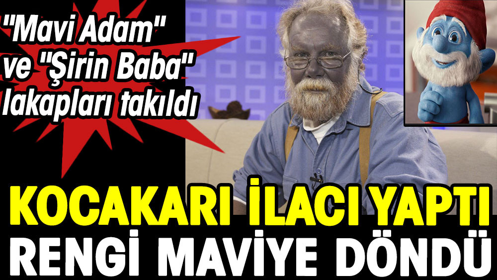 Mavi Adam ve Şirin Baba lakapları takıldı. Kocakarı ilacı yaptı rengi maviye döndü - Resim: 1